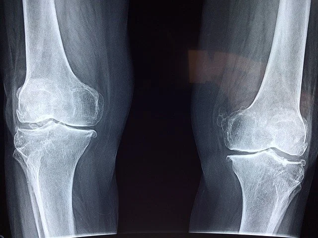 ortopeda katowice